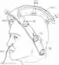 Fig. 01 - Apparatus to secure field generating device to chair