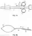 Fig. 09 - Cinch ligating assembly