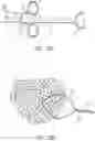 Fig. 19 - Cinch ligating assembly