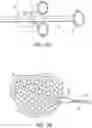 Fig. 20 - Cinch ligating assembly