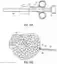 Fig. 22 - Cinch ligating assembly