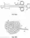 Fig. 23 - Cinch ligating assembly