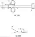 Fig. 25 - Cinch ligating assembly
