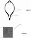 Fig. 37 - Cinch ligating assembly