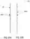 Fig. 38 - Cinch ligating assembly
