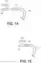 Fig. 08 - Implant fixation devices and methods of using the same