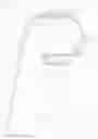Fig. 02 - WEARABLE DEVICE FOR DELIVERING ELECTRICAL STIMULATION TO THE P6 ACUPUNCTURE POINT