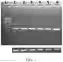 Fig. 02 - Method of treating endothelial dysfunction