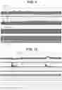 Fig. 07 - Non-invasive nerve stimulation to patients