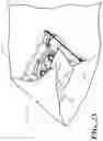 Fig. 22 - Catheter tray, packaging system, instruction insert, and associated methods