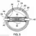 Fig. 05 - Film wrap dispensing device