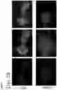 Fig. 11 - L-glass: a novel functionalization method for covalently attaching ECM protein to optical glass