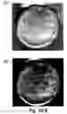 Fig. 04 - Cell-support matrix having narrowly defined uniformly vertically and non-randomly organized porosity and pore density and a method for preparation thereof