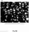 Fig. 13 - Cell-support matrix having narrowly defined uniformly vertically and non-randomly organized porosity and pore density and a method for preparation thereof
