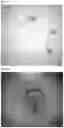 Fig. 05 - METHOD FOR REMOVAL OF YOLK