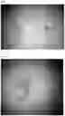 Fig. 06 - METHOD FOR REMOVAL OF YOLK