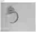 Fig. 07 - METHOD FOR REMOVAL OF YOLK