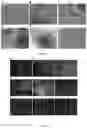 Fig. 02 - Method for producing photoreceptor cells, retinal pigmented epithelial cells, and retinal organoids