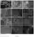 Fig. 04 - Method for producing photoreceptor cells, retinal pigmented epithelial cells, and retinal organoids