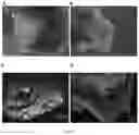 Fig. 08 - Method for producing photoreceptor cells, retinal pigmented epithelial cells, and retinal organoids