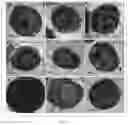 Fig. 12 - METHOD FOR PREPARING HETEROGENEOUS HEMATOPOIETIC STEM AND PROGENITOR CELLS USING NON-MOBILIZED PERIPHERAL BLOOD