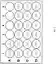 Fig. 02 - Direct effect of extracted BMP on Mesenchymal Stem Cell Differentiation for use in a Culture Medium, Diagnostic Assay, and Adjunct or Stand-Alone Pharmaceutical Treatment