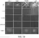 Fig. 15 - Mumps virus as a potential oncolytic agent