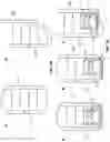 Fig. 02 - Adaptive electrode arrangement and method