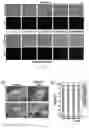 Fig. 07 - METHOD OF MANUFACTURING VESICLES BY DELIVERY OF RNA NANOPARTICLES AND VESICLES MANUFACTURED USING THE SAME