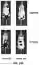 Fig. 25 - Methods and compositions for modulating splicing