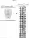 Fig. 29 - MODULATION OF IMMUNE RESPONSE THROUGH STIMULATOR OF INTERFERON GENES