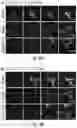 Fig. 08 - Optogenetic induction of membraneless organelles