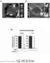 Fig. 29 - Optogenetic induction of membraneless organelles