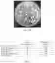 Fig. 03 - Symbiotic fermentation of and and applications thereof