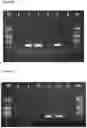 Fig. 09 - HIGHLY POLYMORPHIC AND MODULAR EXTRAGENIC (H.P.M.E.) MARKERS WITHIN SPECIFIC TAXA OF MICROORGANISMS AND USE THEREOF FOR THEIR DIFFERENTIATION, IDENTIFICATION AND QUANTIFICATION