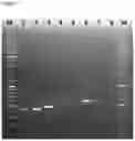 Fig. 15 - HIGHLY POLYMORPHIC AND MODULAR EXTRAGENIC (H.P.M.E.) MARKERS WITHIN SPECIFIC TAXA OF MICROORGANISMS AND USE THEREOF FOR THEIR DIFFERENTIATION, IDENTIFICATION AND QUANTIFICATION