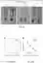 Fig. 09 - Assay for the Rapid Detection of Nucleic Acids via a Modified LAMP Reaction Coupled with Colorimetric Reporter Utilizing a Gold Nanoparticle Peptide Nucleic Acid AuNP-PNA Probe System