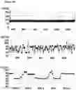 Fig. 31 - Method of improving the movement of a target polynucleotide with respect to a transmembrane pore