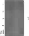 Fig. 32 - Systems and methods for writing, reading, and controlling data stored in a polymer