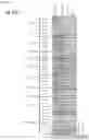 Fig. 23 - NcRNA and uses thereof