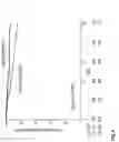 Fig. 03 - Method for breast cancer recurrence prediction under endocrine treatment