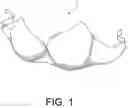 Fig. 02 - UNDERGARMENT AND METHOD FOR MANUFACTURING THE UNDERGARMENT