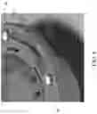 Fig. 07 - Closet flange with bolt support