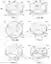Fig. 04 - Shaped cutters