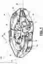 Fig. 02 - Torque wrench system having multiple torque stations
