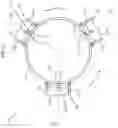Fig. 03 - Inertial force polarizer apparatus