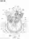 Fig. 61 - High-pressure pump