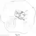 Fig. 41 - Bracketry for ceiling fan or lamp retrofits and method of installing same