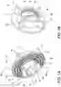 Fig. 02 - Retention device for supporting a component and method of use
