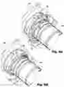 Fig. 05 - Retaining ring assemblies